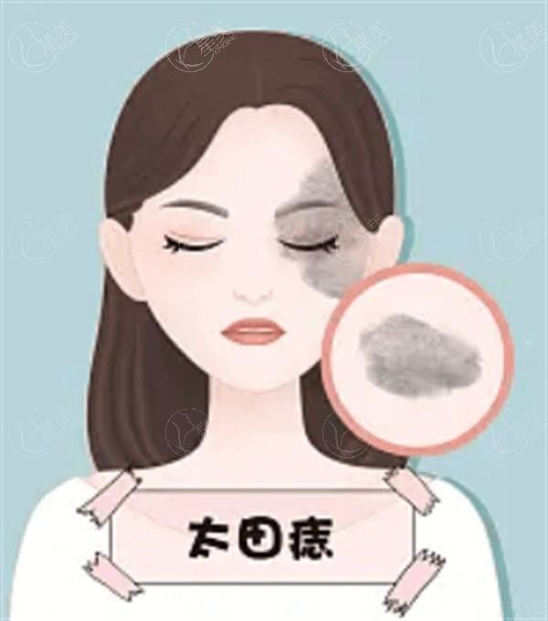 安排武汉医美医院吸脂塑形整形价格一览表 瘦手臂4000起，收费透明不坑人