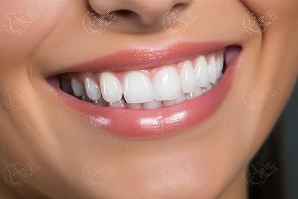 洛阳半隐形陶瓷牙齿矫正哪里做得好又比较正规? 听说高士洁、栾川小天鹅、欧乐正规口碑好