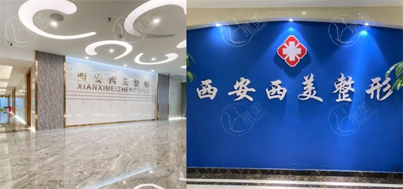 西安西美整形外科门诊部 网友反馈他家技术好收费也不贵
