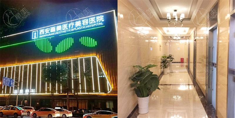 西安西美整形外科门诊部 网友反馈他家技术好收费也不贵