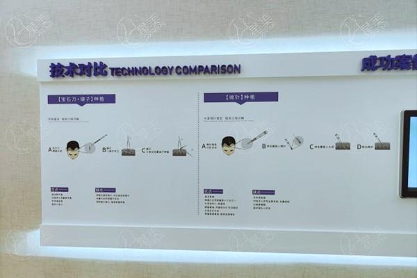 成都大麦植发是正规植发机构,必看植发技术+价格表+口碑评价
