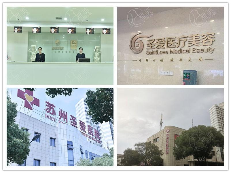 看一看苏州圣爱整形口腔医院医美项目收费标准一览 医院正规评价挺高的 