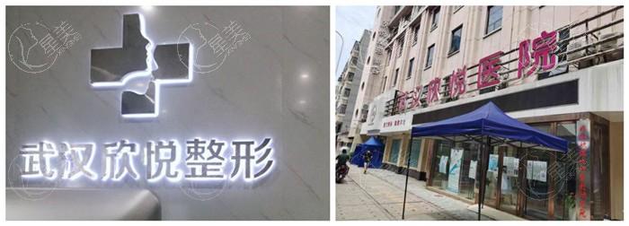 武汉欣悦整形可靠吗 看完都说他家正规又靠谱
