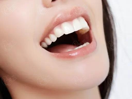 佛山泽康氧化锆全瓷哪家正规又靠谱？ 壹加壹技术靠谱性价比高