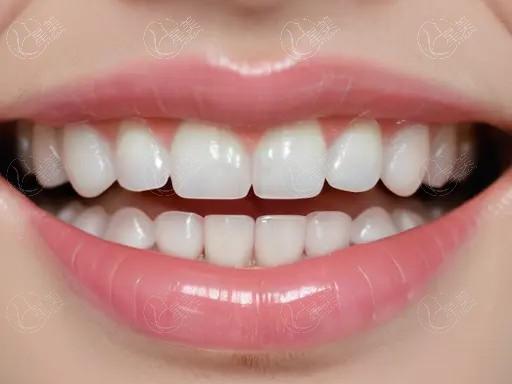 昆明美国皓圣植体7大排名榜已上线 皆是昆明美国皓圣植体实力好医院