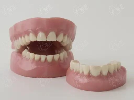 昆明美国皓圣植体7大排名榜已上线 皆是昆明美国皓圣植体实力好医院