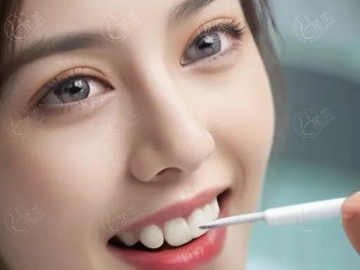 广州瓷化树脂充填哪个口腔医院可以做 博德美加/广州柏德口腔/曙光美云技术都不错！