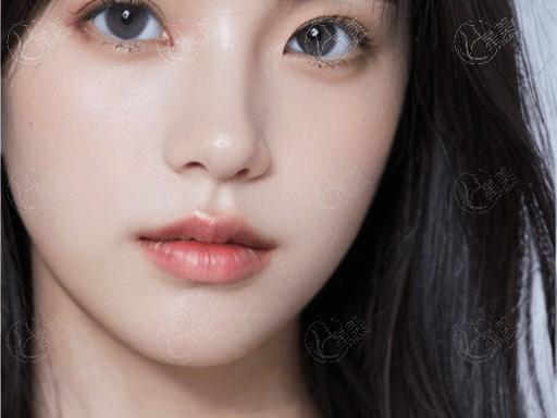 昆明环缩耳整形医院哪家好 有名的是娇点/云南铜雀台整形医院/韩辰