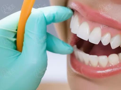 南京3D锆齿美白好的医院排名 溧水英博、金铂利、南京美奥口腔等技术强 南京3D锆齿美白好的医院排名 溧水英博、金铂利、南京美奥口腔等技术强