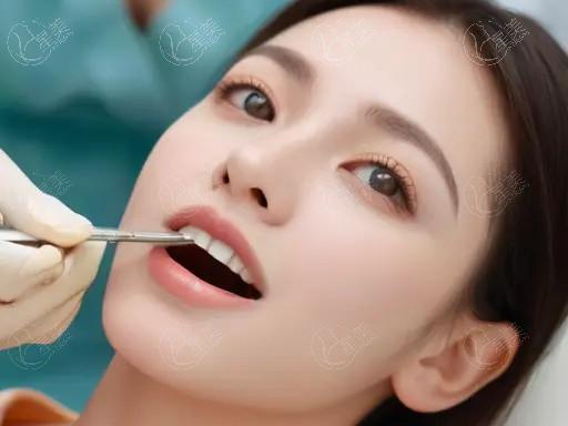 2024乌鲁木齐牙科的医院贴面收费标准公开 树脂贴面3000|超薄瓷贴面2000