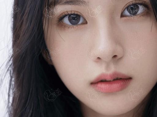 昆明美伊莱医疗美容医院挺正规的，位于盘山区北京路眼、鼻、脂肪项目技术杠杠的