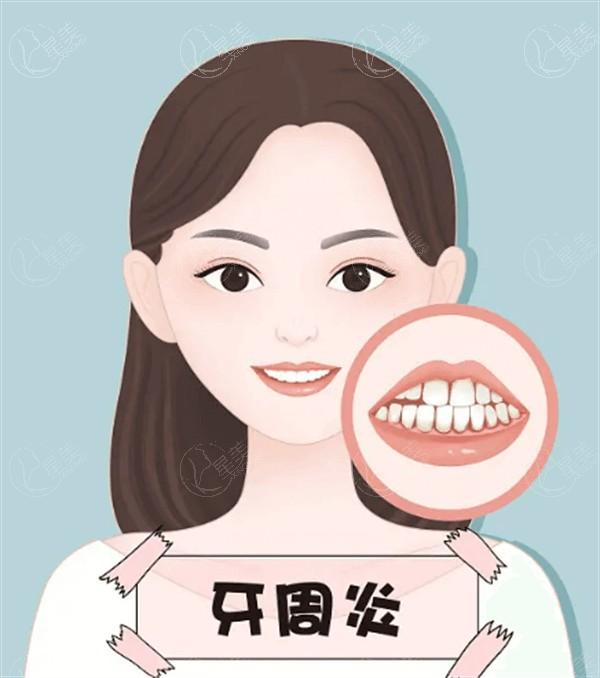 北京加减美双眼皮修复怎么样?亲测范惟双眼皮修复技术好价格实惠