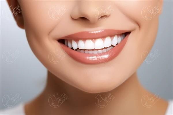 速览西安牙科的医院牙齿矫正收费标准公开 含达芬奇隐形矫正|瑞速齐隐形牙套|Spark隐形牙套|适美乐隐形矫正价格