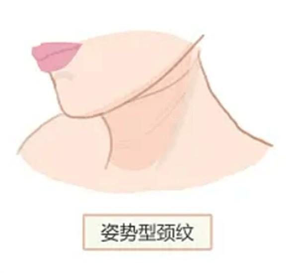 全新福州整形医院毛发种植收费价格 毛发种植才15000+、头顶加密种植3000起
