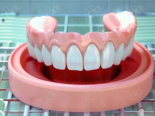 郑州冷光美白口碑好又便宜的口腔医院 榜上前3都是郑州当地口碑好的