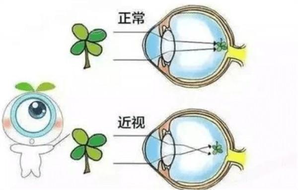 瞅瞅常州眼科医院青光眼手术价格表 价格表显示青光眼手术16300/元起