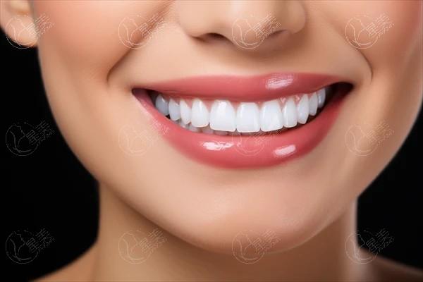 厦门舌侧矫正好的口腔医院排名 登特/康德佳/峰煜等医院上榜