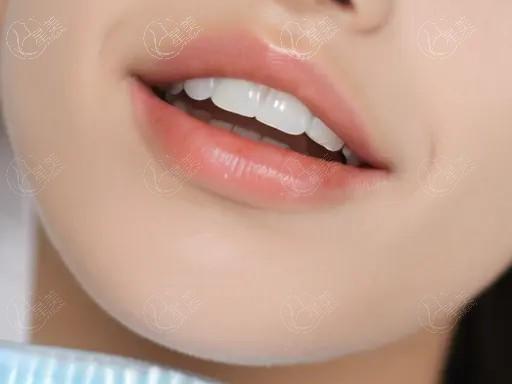 佛山瑞士百丹特种植体正规口腔医院排名公布 榜单前7正规又好 佛山瑞士百丹特种植体正规口腔医院排名公布 榜单前7正规又好