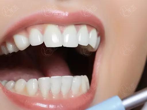 常州国产cdic种植牙有名的口腔医院排名 get便宜又好的几家分享大家 常州国产cdic种植牙有名的口腔医院排名 get便宜又好的几家分享大家