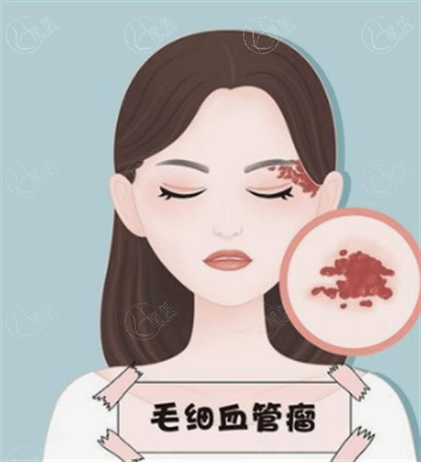 瞅瞅杭州整形医院其它整形价格表 斜颈矫正手术|女变男|直腿术|其它整形费用公开