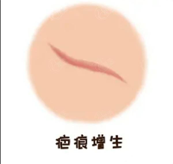 深圳阳光整形医院地铁几号线能到:1/5/9号线地铁攻略医院优势医生团队大揭秘