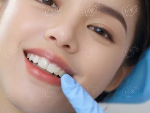 新版广州牙科的医院全瓷牙要多少钱 全瓷牙、泽康全瓷牙、悦美氧化锆、拉瓦全瓷牙部分有折扣