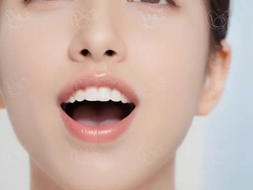 更新杭州牙科的医院牙齿美白收费标准公开 3D锆齿美白/冷光美白/激光美白没想象的贵