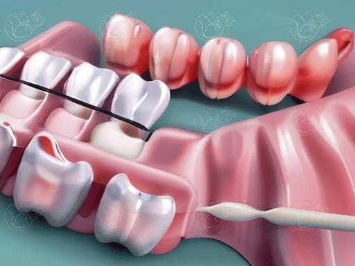 乌鲁木齐种牙好又便宜的口腔医院名单 口碑好又正规的口腔诊所