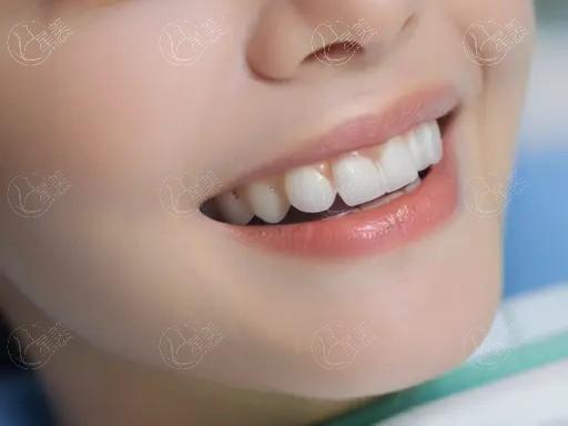 郑州儿童窝沟封闭排名好的口腔医院名单 郑州中诺口腔/中诺/郑州橙意口腔实力不俗