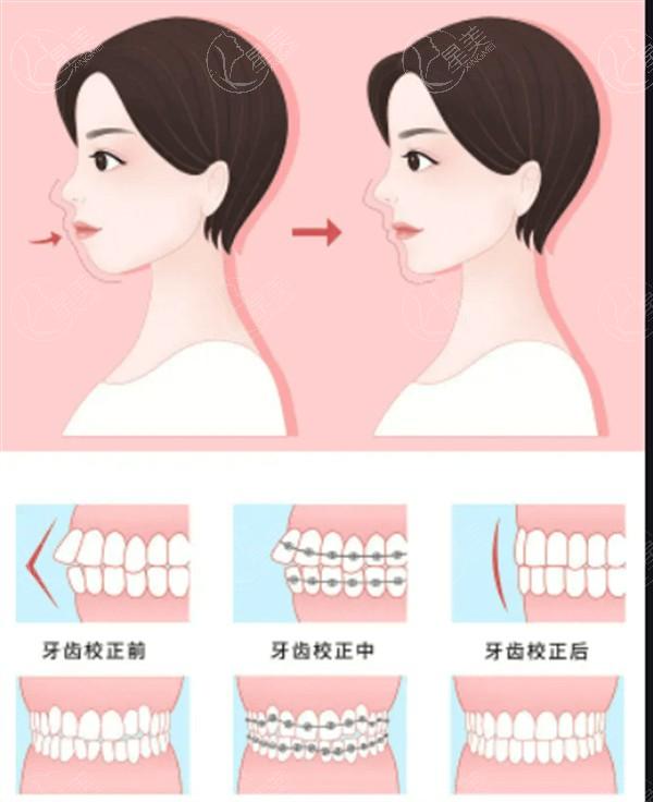 南京美贝尔整形医院怎么样？ 从口碑看正规又好很可靠!