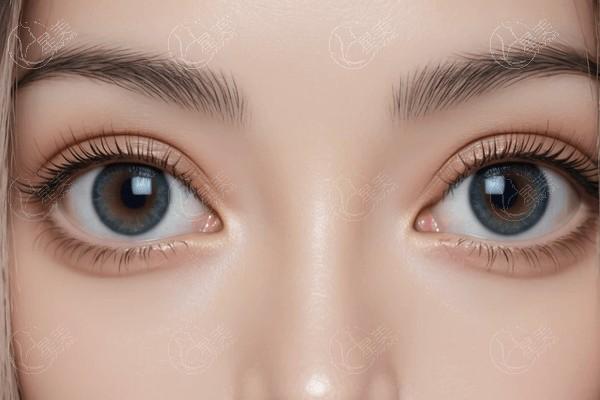 当兵考大学近视眼怎么办?来乌鲁木齐美尼康眼科医院近视眼手术技术可靠价格合理