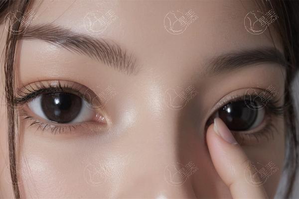 深圳双眼皮修复哪家整形医院比较好？筛选几家价格实惠技术赞的医院