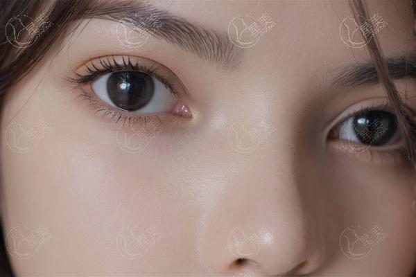 大连爱德丽格整形医院到底可信吗？很确定是眼修复实力强的整形医院很靠谱