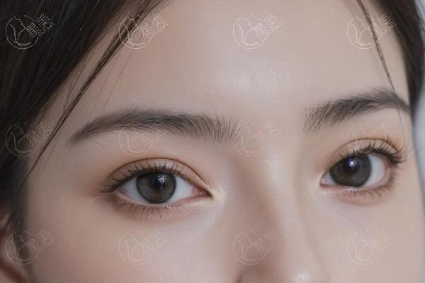 武汉做双眼皮哪家整形医院技术好？卓美/艺星/美莱整形都在榜上
