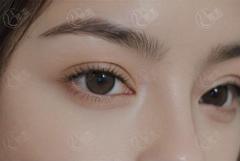 惠州百佳伊丽莎白妇产医院整形科 本地人都说收费不贵且正规