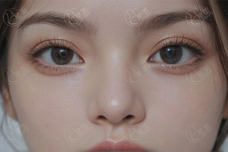 上海盈美整形隆鼻收费高不高?确认收费透明且有优惠活动 上海盈美整形隆鼻收费高不高?确认收费透明且有优惠活动