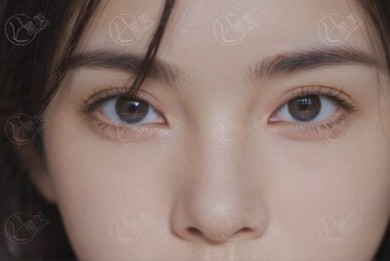 东莞整形哪家好?技术好价格合理的医美机构推荐这几家