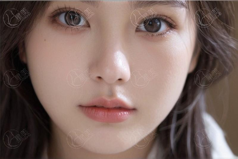 还在找哈尔滨割双眼皮技术好的地方？这几家值得一去！
