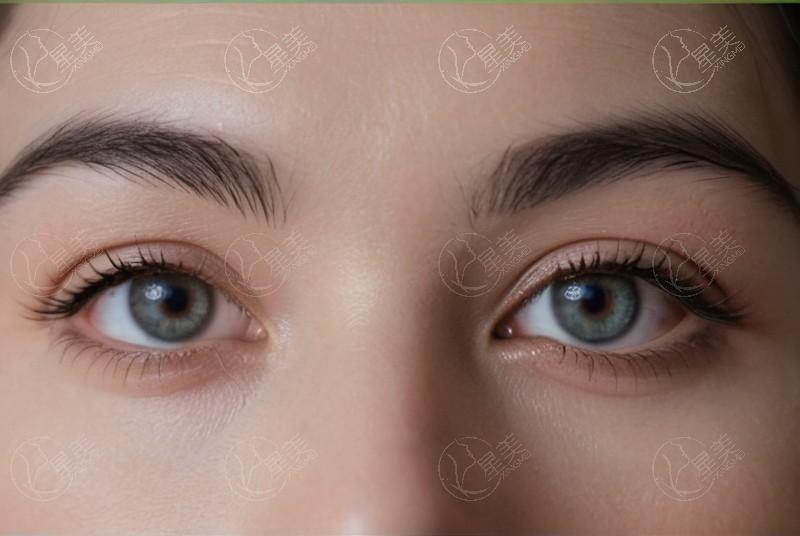 北京熙仁眼科治青光眼可靠?王乐今主任微创手术控制眼压效果好