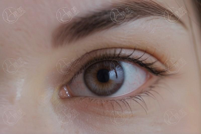 谁知道上海普瑞眼科近视眼手术好不好？医生团队强收费透明