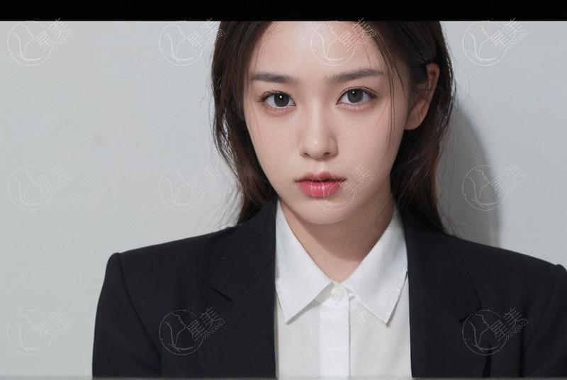 招风耳矫正术后：关键恢复期注意事项清单