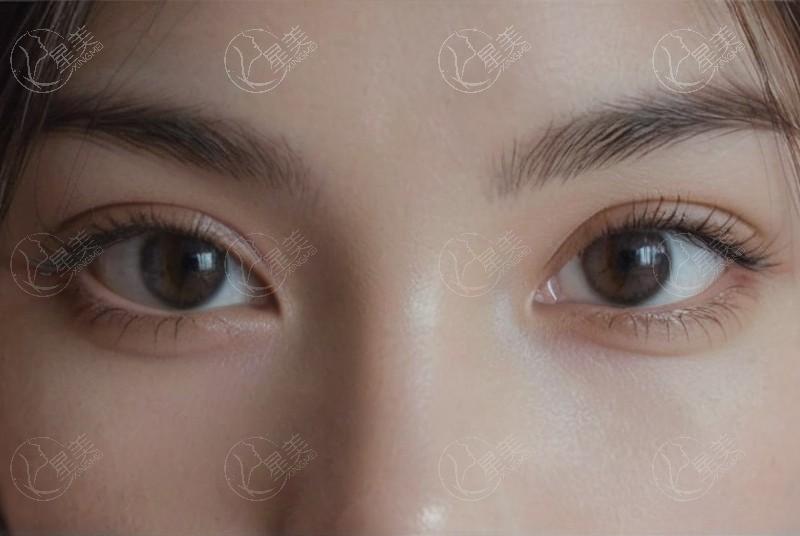 天津伊美尔医疗美容正规吗？熊斌做隆胸及私密整形口碑不错