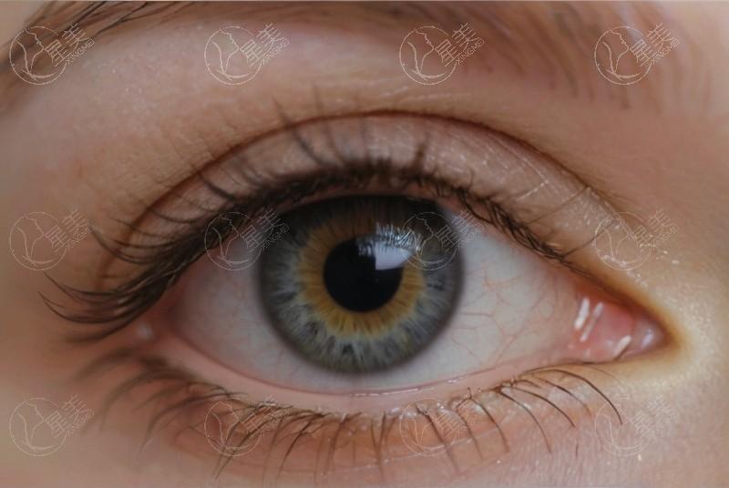 上海眼科医院哪家做白内障手术强？技术和口碑双优的五官科、爱尔等排名靠前
