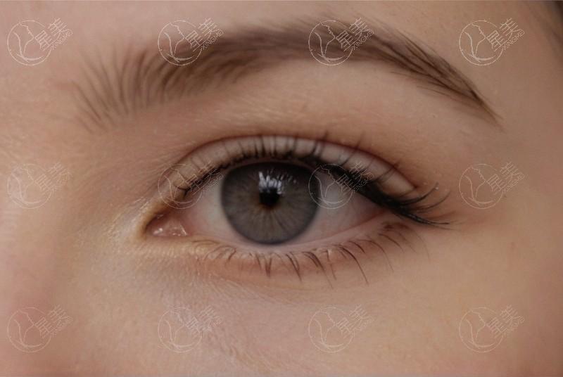 广州眼科医院口碑排名前十！斜视治疗哪家医院好:爱尔眼科等优势明显