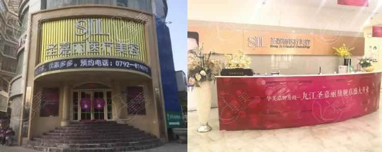 九江圣嘉丽医疗美容门诊部靠谱吗：资质正规且口碑爆棚价格亲民