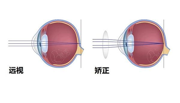 网友问贵港爱眼眼科医院收费高不高？查实价格亲民且无隐形消费