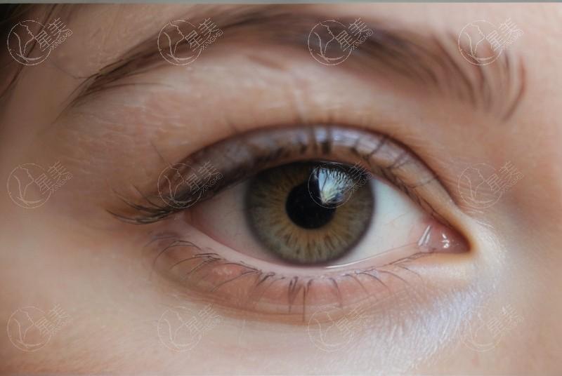 网友问内蒙包头致亮眼科医院收费价目表？查实收费合理且口碑好