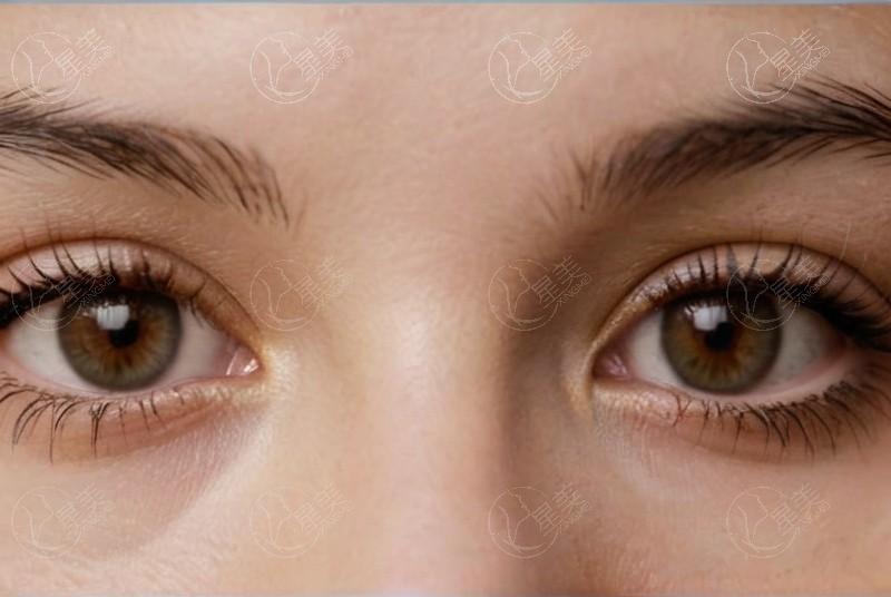 抚顺海睿眼视光眼科验光收费贵吗？价格合理且口碑好